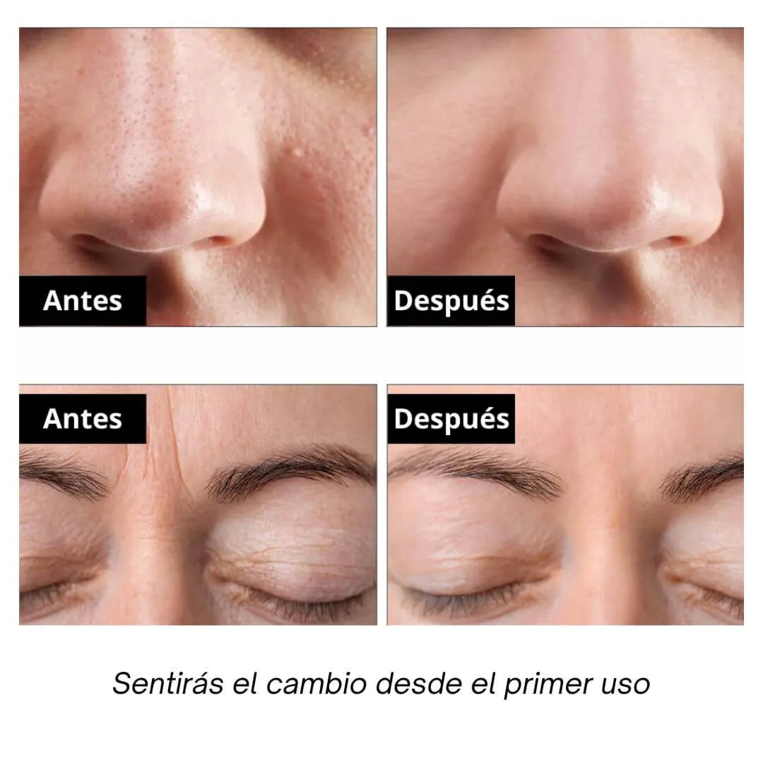 Peeling Ultrasonico - Skin Scrubber