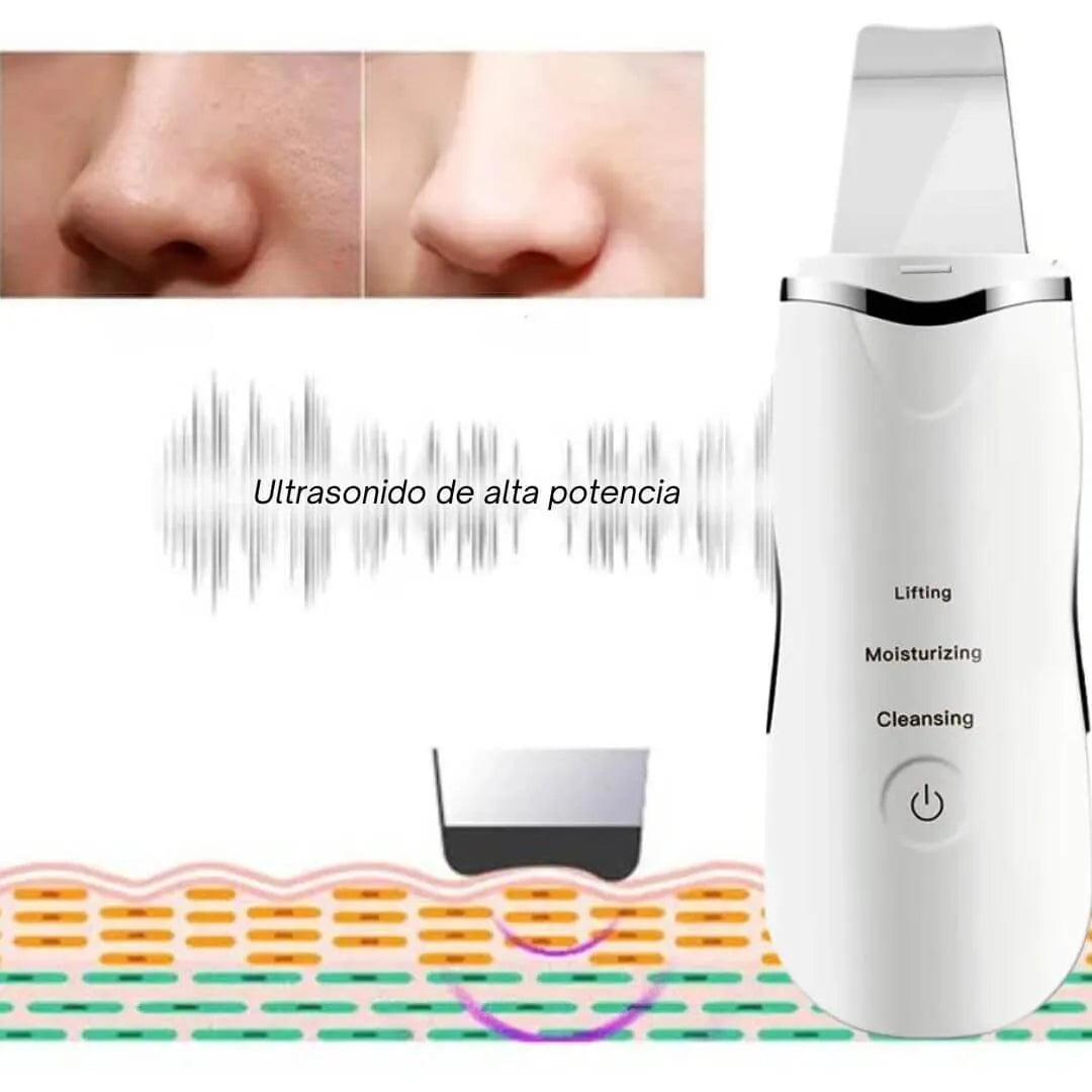 Peeling Ultrasonico - Skin Scrubber