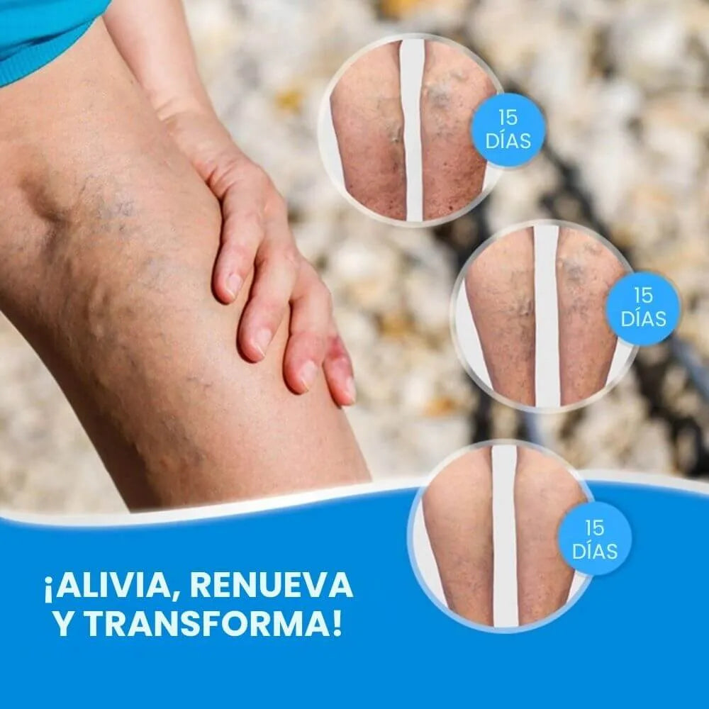 Parches para Várices - VaricoseCare Pro® | Recupera la belleza y bienestar de tus piernas