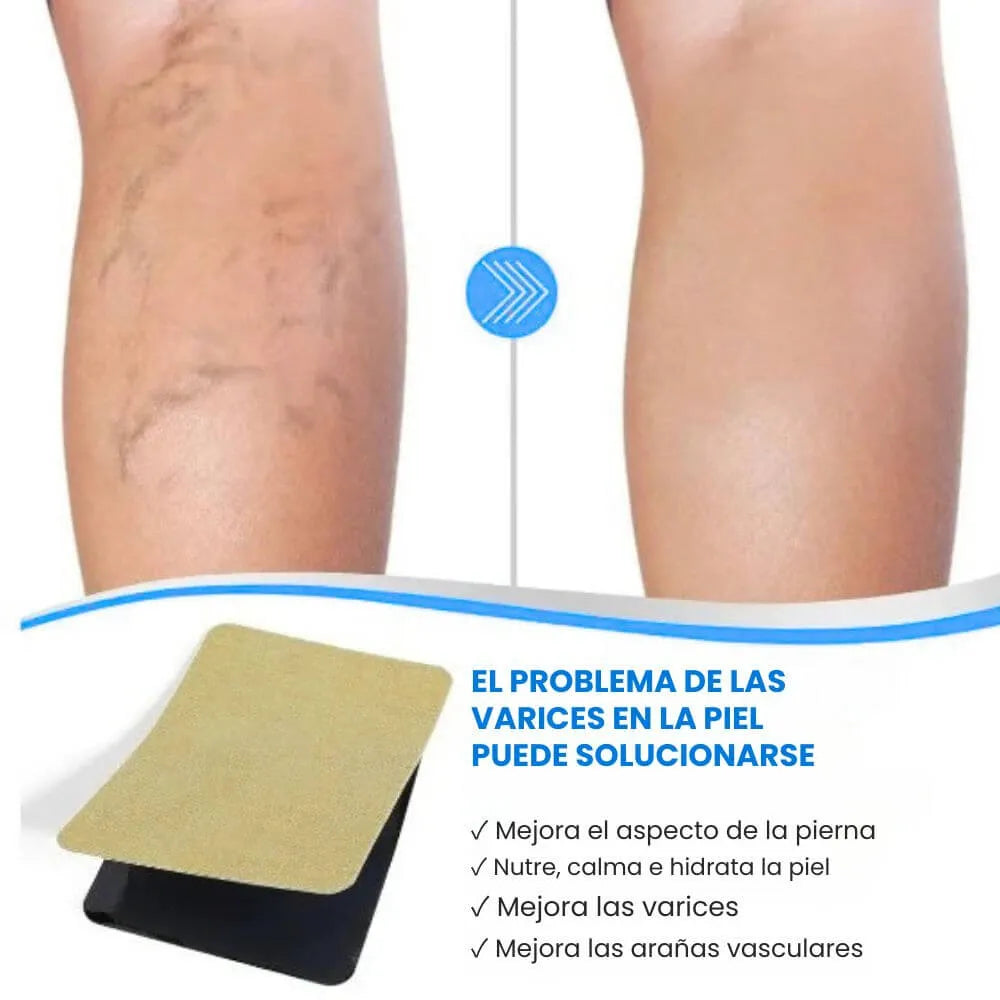 Parches para Várices - VaricoseCare Pro® | Recupera la belleza y bienestar de tus piernas