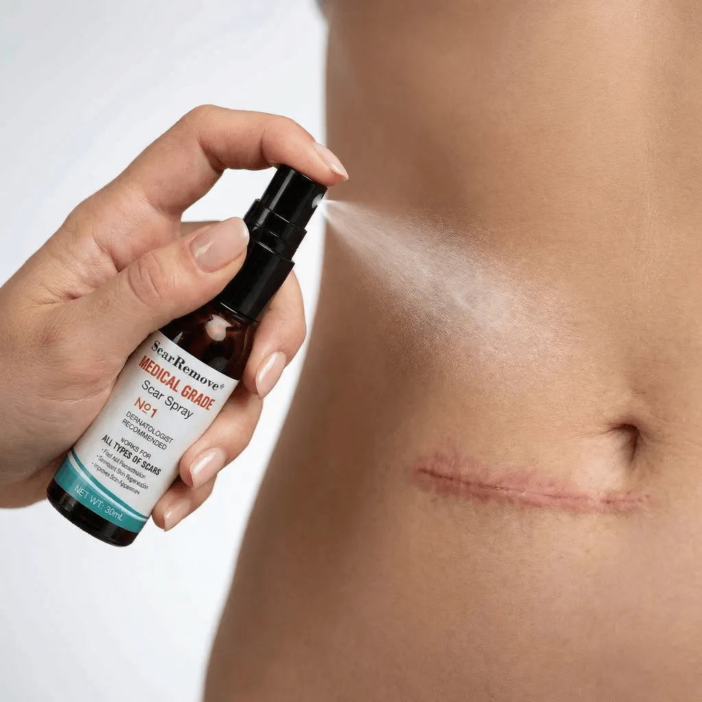 Spray Cicatrizante ScarRemove®