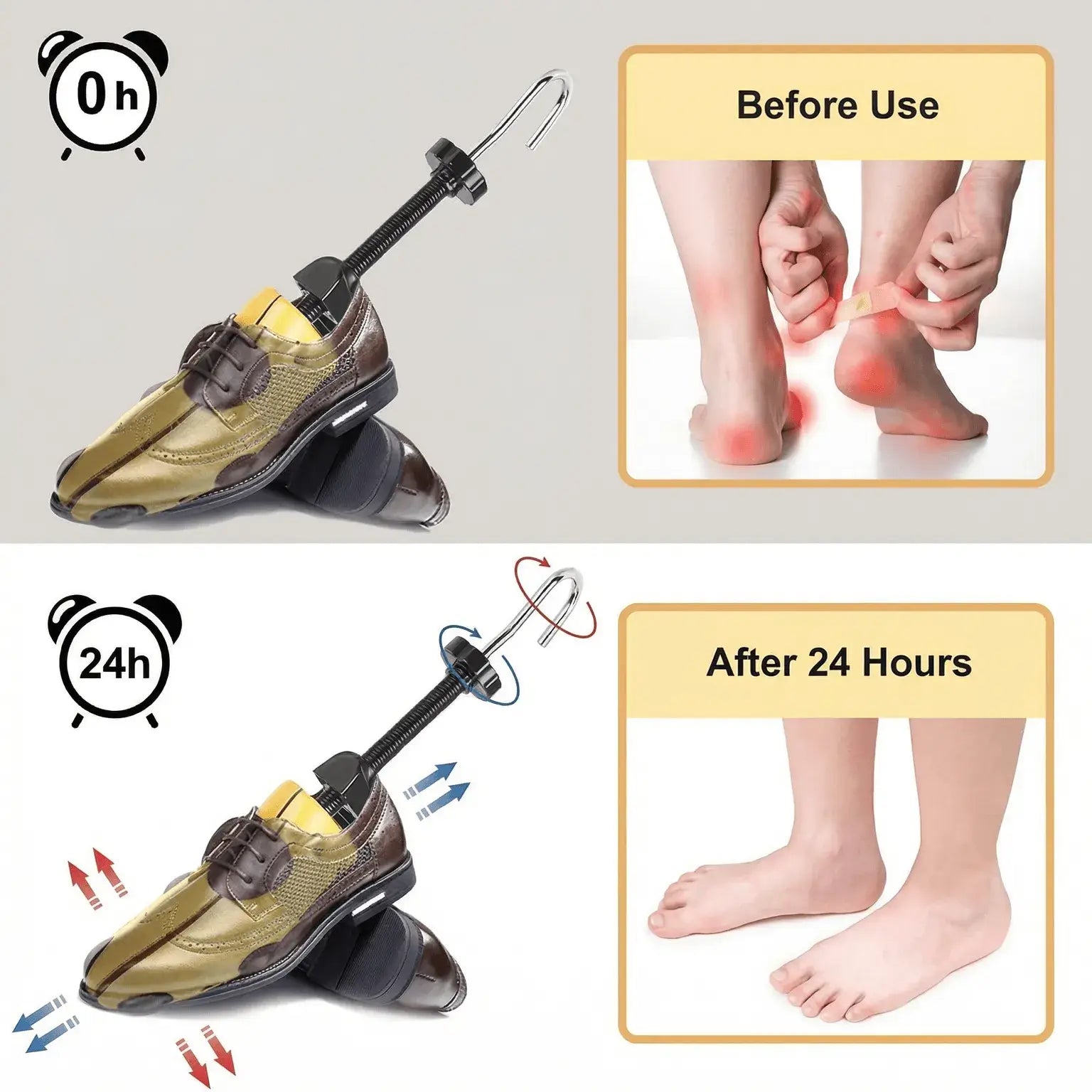 Expansores De Zapatos  - ComfortPro
