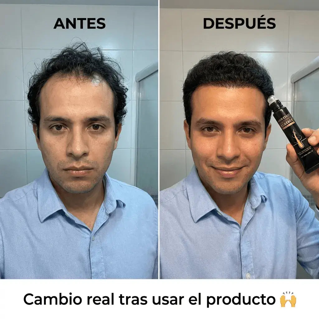Hair Boost V1
